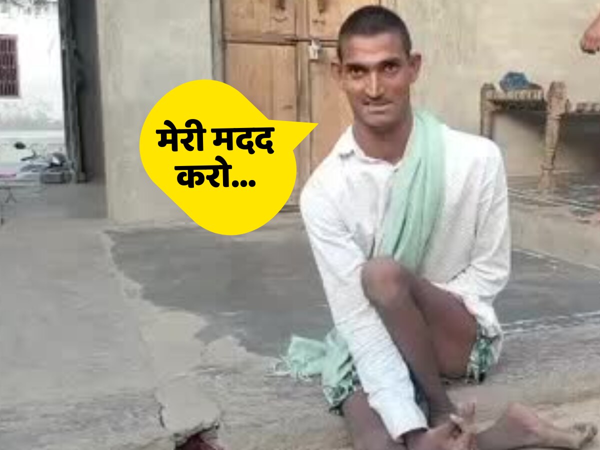 Bhilwara news: गरीबी से लाचार मां नहीं करा पा रही बेजुबान बेटे का इलाज, हाथों से इशारा करके CM गहलोत से लगाई गुहार