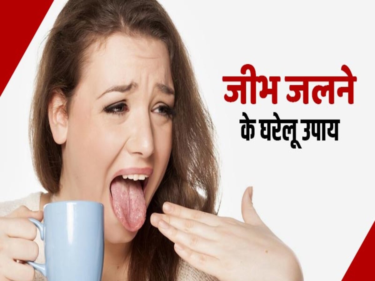 Burnt Tongue: ज्यादा गर्म खाने से जल गई है जीभ? आजमाएं दादी-नानी के ये नुस्खे, तुरंत मिलेगा आराम