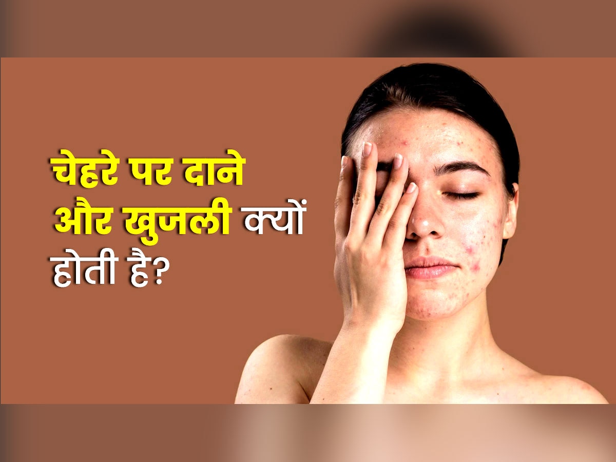 lifestyle news indian home remedies for skin rashes and itching daane