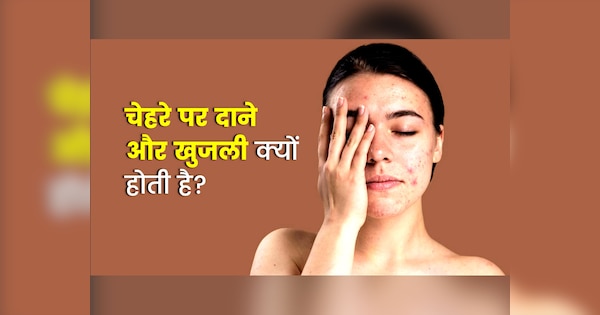 lifestyle-news-indian-home-remedies-for-skin-rashes-and-itching-daane