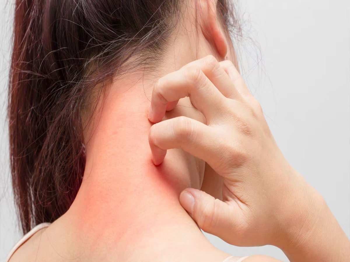 lifestyle news indian home remedies for skin rashes and itching daane