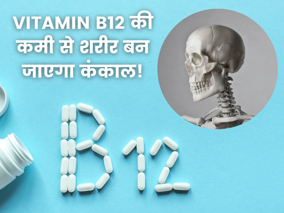 Vitamin B12 Deficiency: शरीर को कंकाल बना देती है विटामिन बी12 की कमी, आज से ही खाना शुरू करें ये 5 चीजें