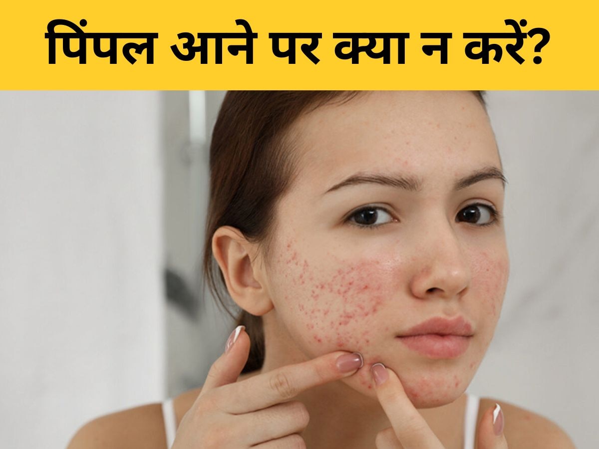 Pimples: मुंहासे आने पर कभी न करें ये 3 गलतियां, बिगड़ सकता है फेस का लुक