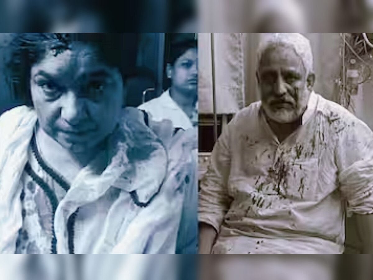Bhopal News: देर रात नेता प्रतिपक्ष और पति पर जानलेवा हमला, दोनों लहुलुहान; गार्ड को मारी छूरी