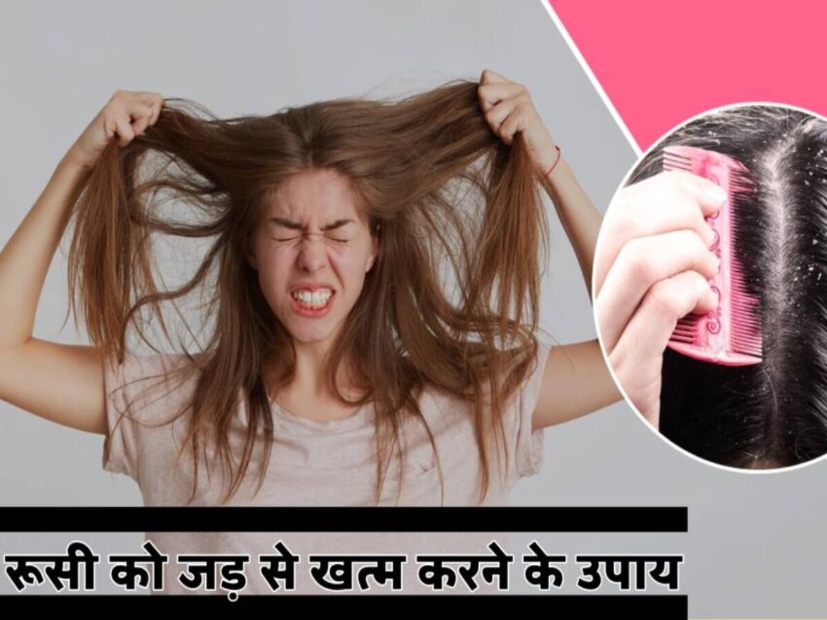 Onion And Ginger Hair Mask To Get Rid Of Dandruff In Hindi Hindi News