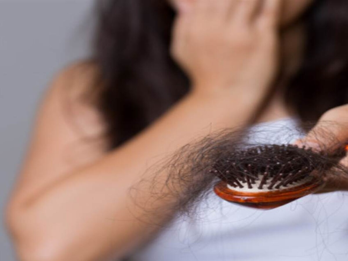 Hairfall: इस विटामिन की कमी से झड़ने लगते हैं बाल, करें ये काम नहीं होगा हेयर फॉल