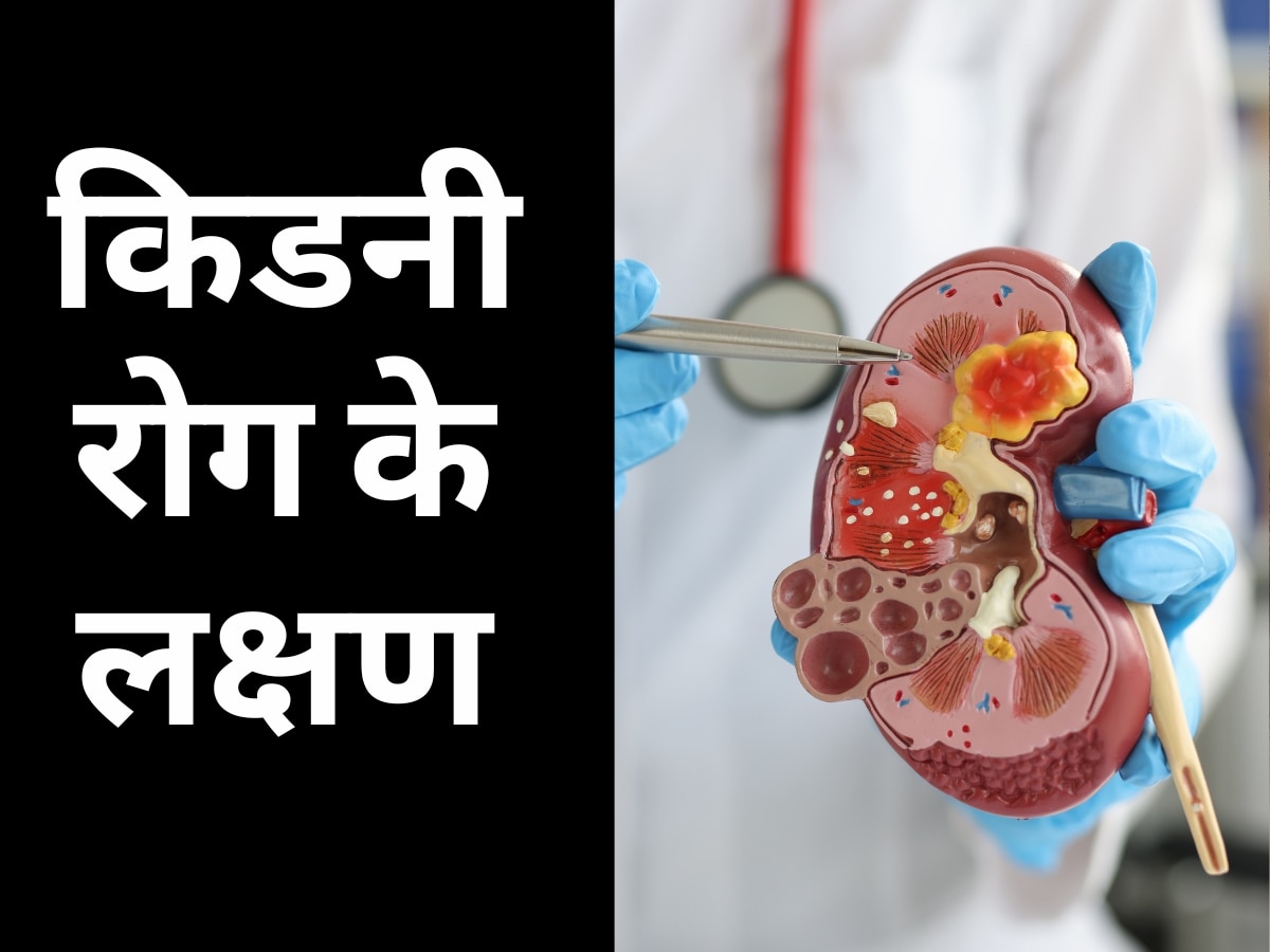 Kidney Disease Symptoms: किडनी की सेहत बिगड़ने पर शरीर में मिलते हैं ये 5 संकेत, इग्नोर करने की न करें गलती