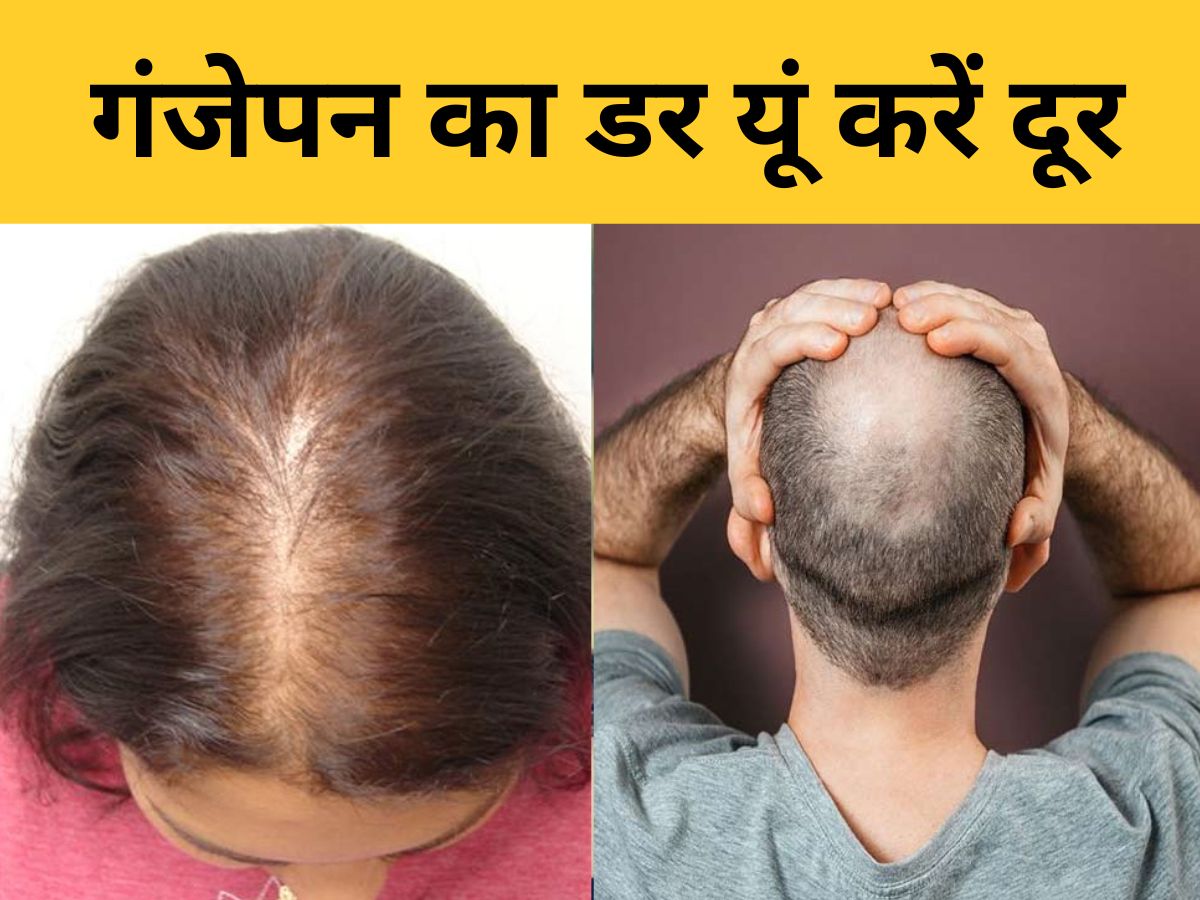 Hair fall after oiling causes in hindi  तल लगन क बद बल कय झडत  ह जन 5 करण