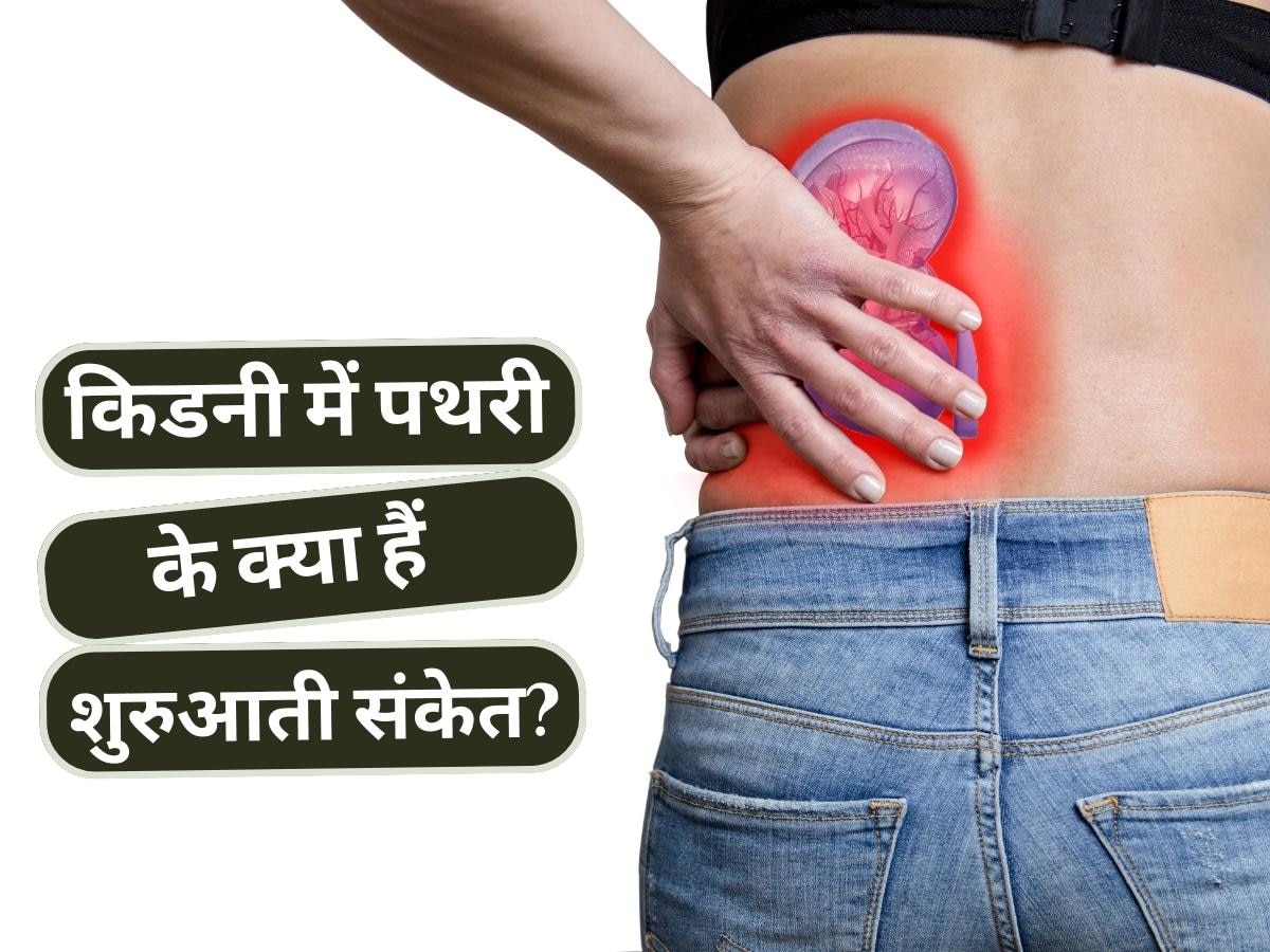 Kidney Stone: किडनी में पड़ गई है पथरी तो इस तरह मिलते हैं संकेत, नजरअंदाज करने की न करें गलती