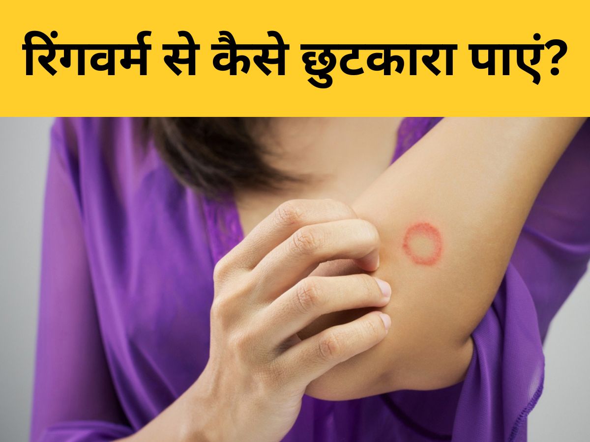 How to Cure Ringworm Treatments Turmeric Cassia Angustifolia Coconut