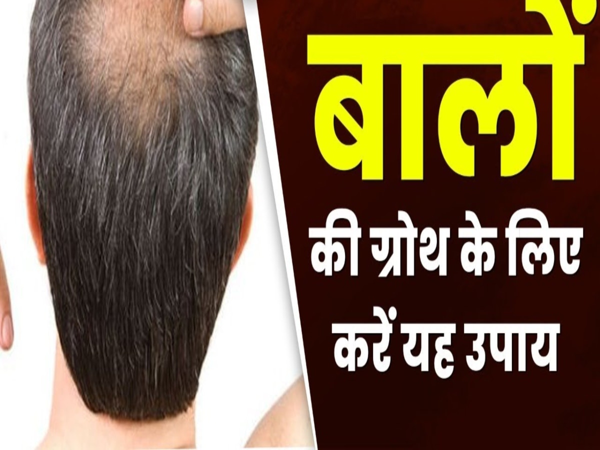 Hair Growth Treatment: गंजे सिर पर उगाना चाहते हैं बाल, तो हफ्ते में 2 बार आजमाएं ये नुस्खा