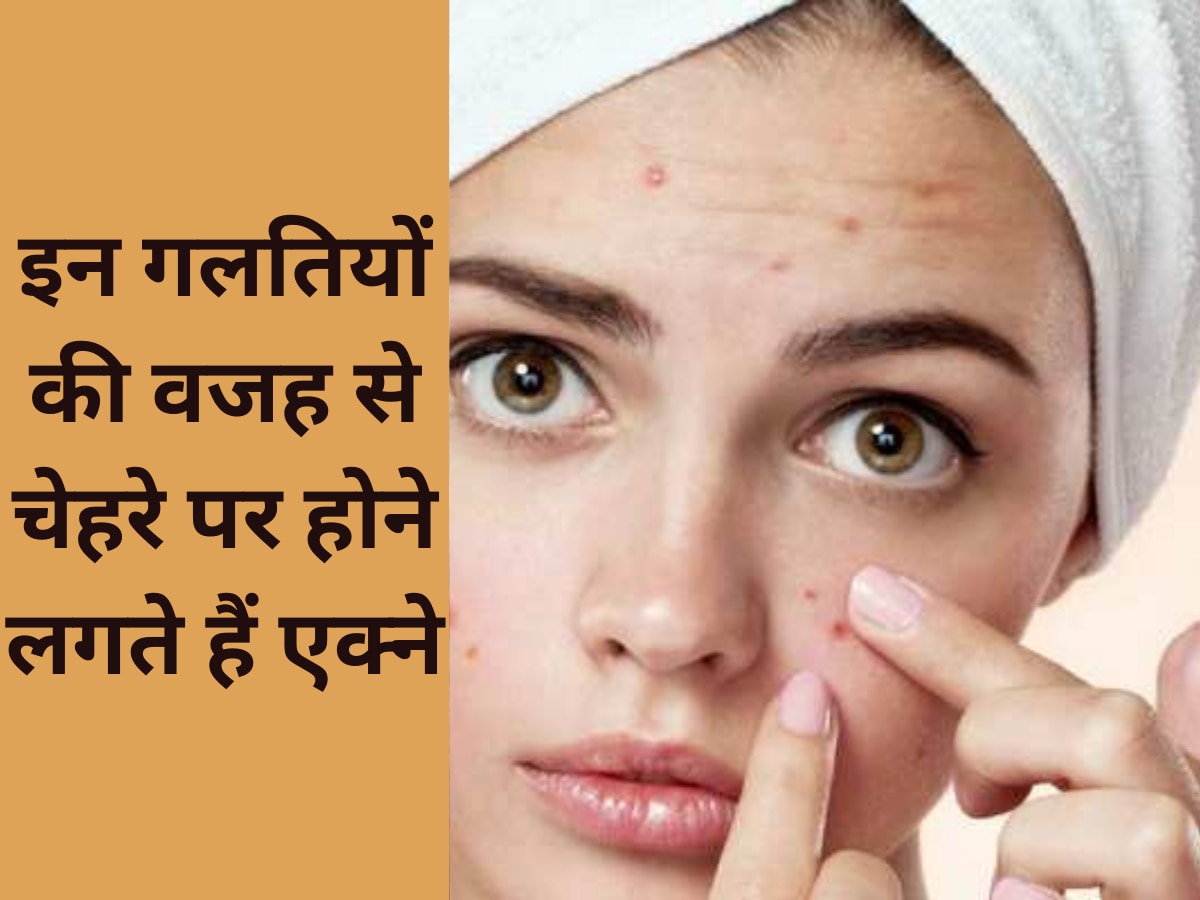Skin Care Tips: इन गलतियों की वजह से चेहरे पर होने लगते हैं एक्ने, जरूर दें ध्यान