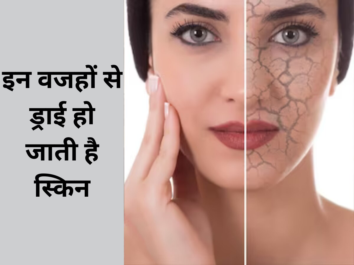 Skin Care Tips: इन वजहों से ड्राई हो सकती है स्किन, गलती से भी न करें इग्नोर