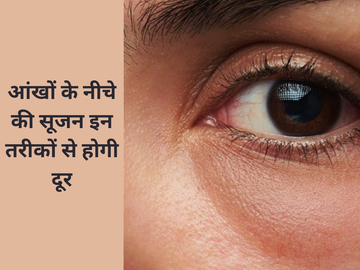 eye care tips to get rid of puffiness under eyes swelling under the