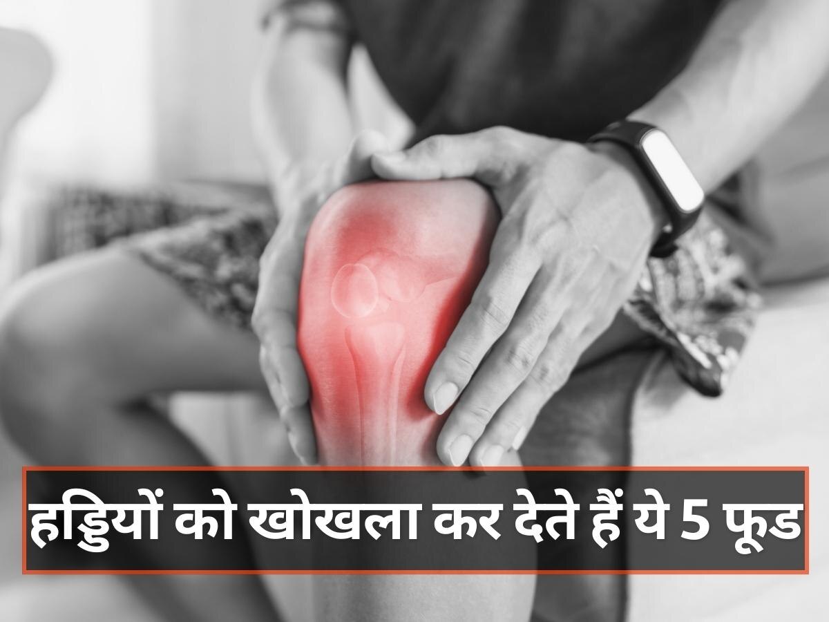 Worst Foods In Arthritis: हड्डियों को खोखला कर देते हैं ये 5 फूड, गठिया के मरीज बना लें इनसे दूरी 