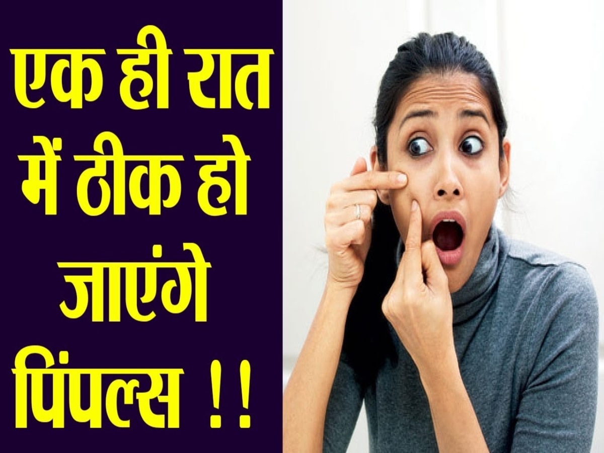 Acne Treatment: एक्ने फ्री स्किन के लिए आजमाएं ये घरेलू उपाय, नहीं लगेगा खूबसूरती पर दाग