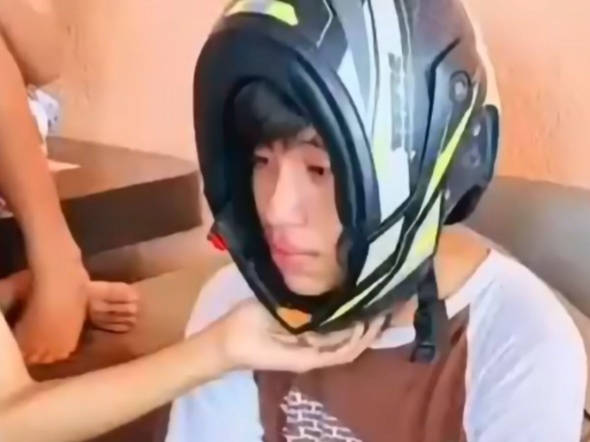 Helmet: लड़के ने ऐसे पहना हेलमेट..सिर में बुरी तरह अटक गया, अब निकल ही नहीं रहा!