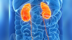 Health Tips: किडनी से जुड़ी बीमारियों करती हैं परेशान, तो इन चीजों से रहें दूर
