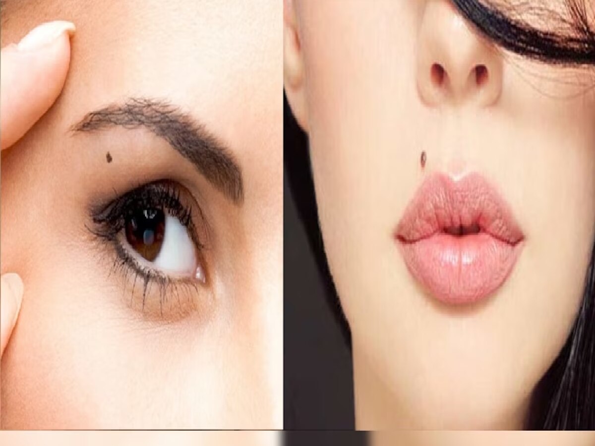 lucky moles on 6 part of of body Male Female Live Whol Life Like King