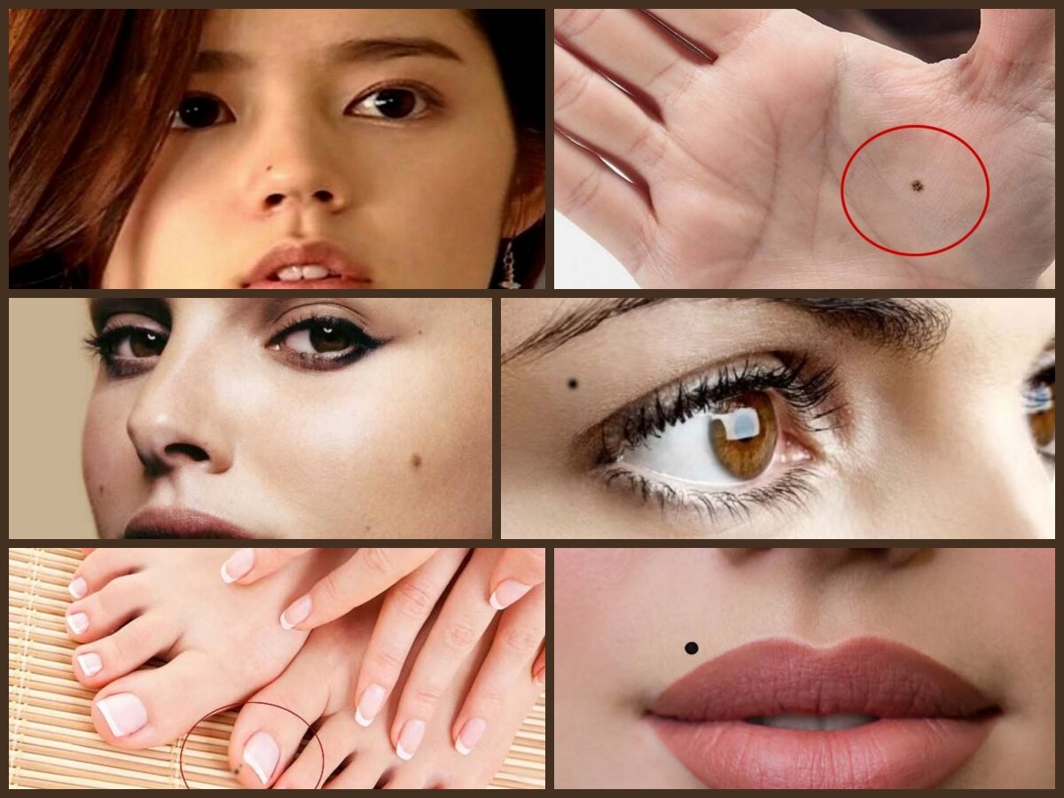 lucky moles on 6 part of of body Male Female Live Whol Life Like King