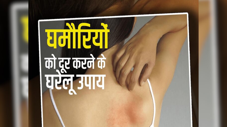 What is the fastest way to cure prickly heat Ghamori Ke Upay | Hindi ...