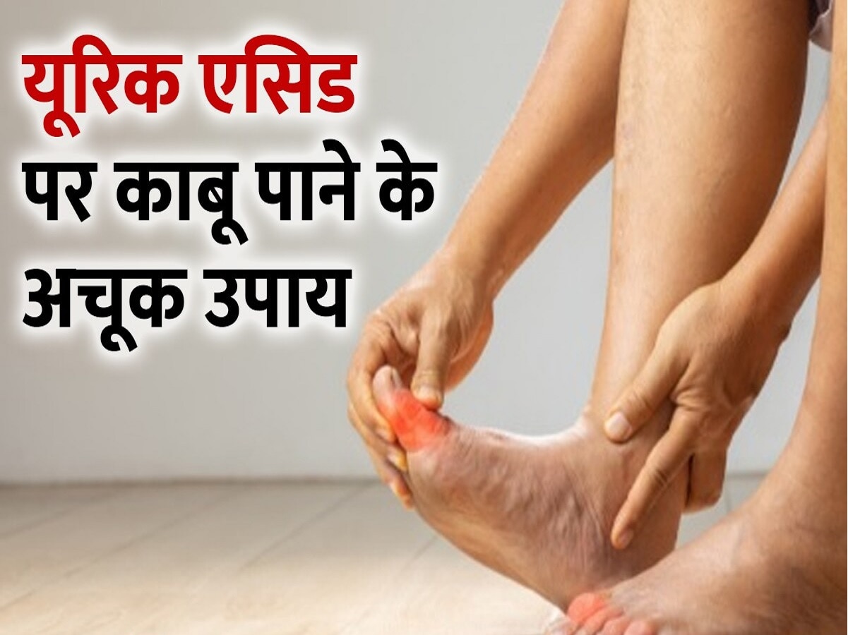 If You Want To Get Rid Of Uric Acid Follow These Easy Methods अगर यूरिक एसिड से पाना चाहते 6592