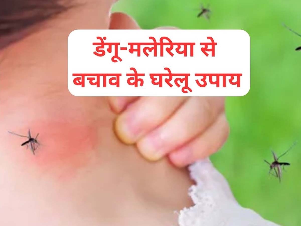 Dengue-Malaria Remedies: शुरू हो चुका है मच्छरों का सीजन, डेंगू-मलेरिया से बचने के लिए घर में तैयार रख लें ये 5 घरेलू दवाएं