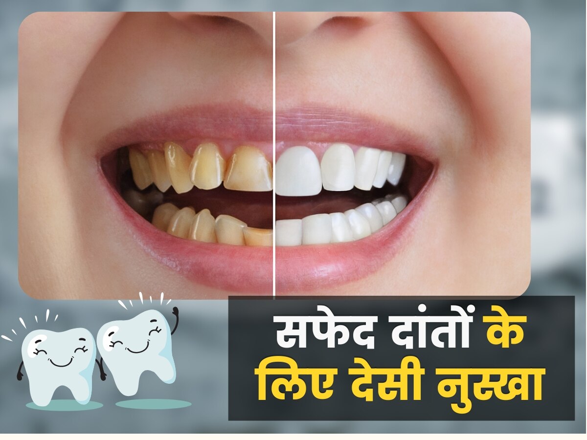 Teeth Whitening Remedy: ब्रश करने के बाद भी दांतों से नहीं जा रहा पीलापन? अपनाएं ये देसी नुस्खा, मोतियों की तरह चमकने लगेंगे दांत