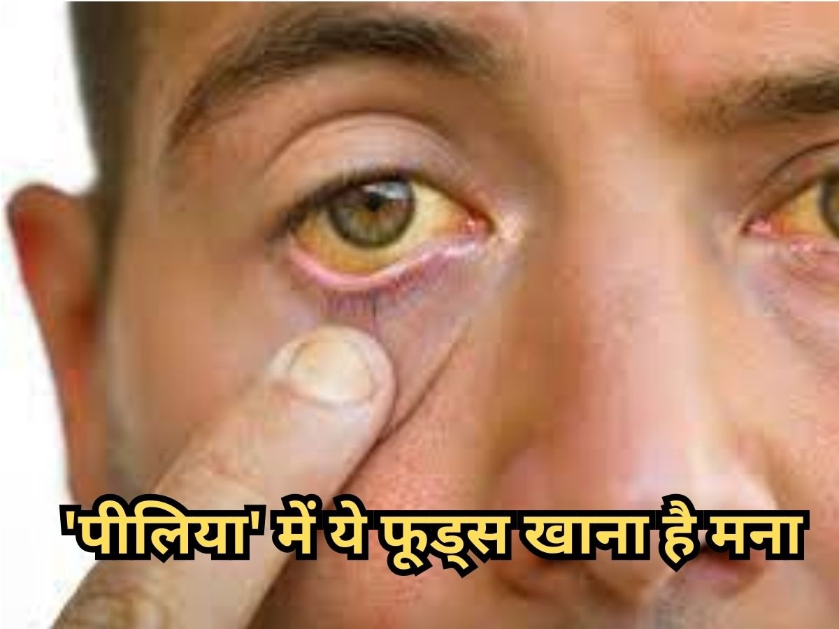 Jaundice Recovery: बरसात के मौसम में हो गई है पीलिया की बीमारी, तो आज से ही फॉलो करें ये डाइट 