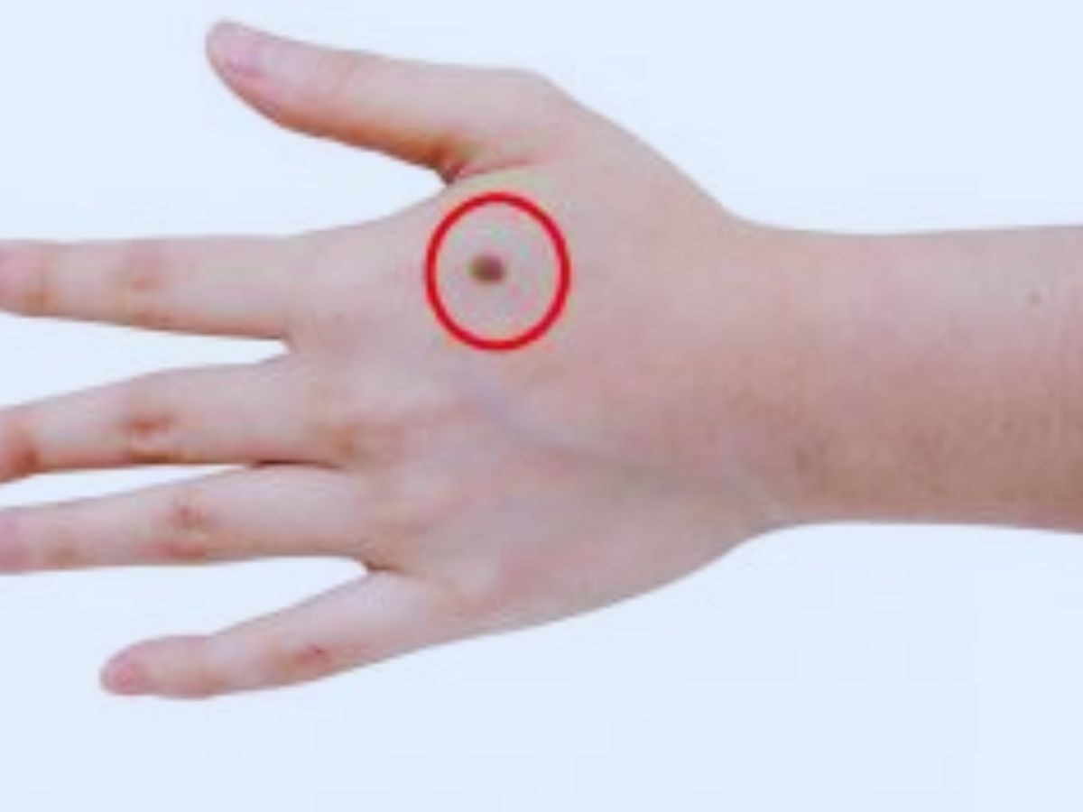 Meaning of Mole on Hand Janiye hatho me til hona kya matlab hota hain