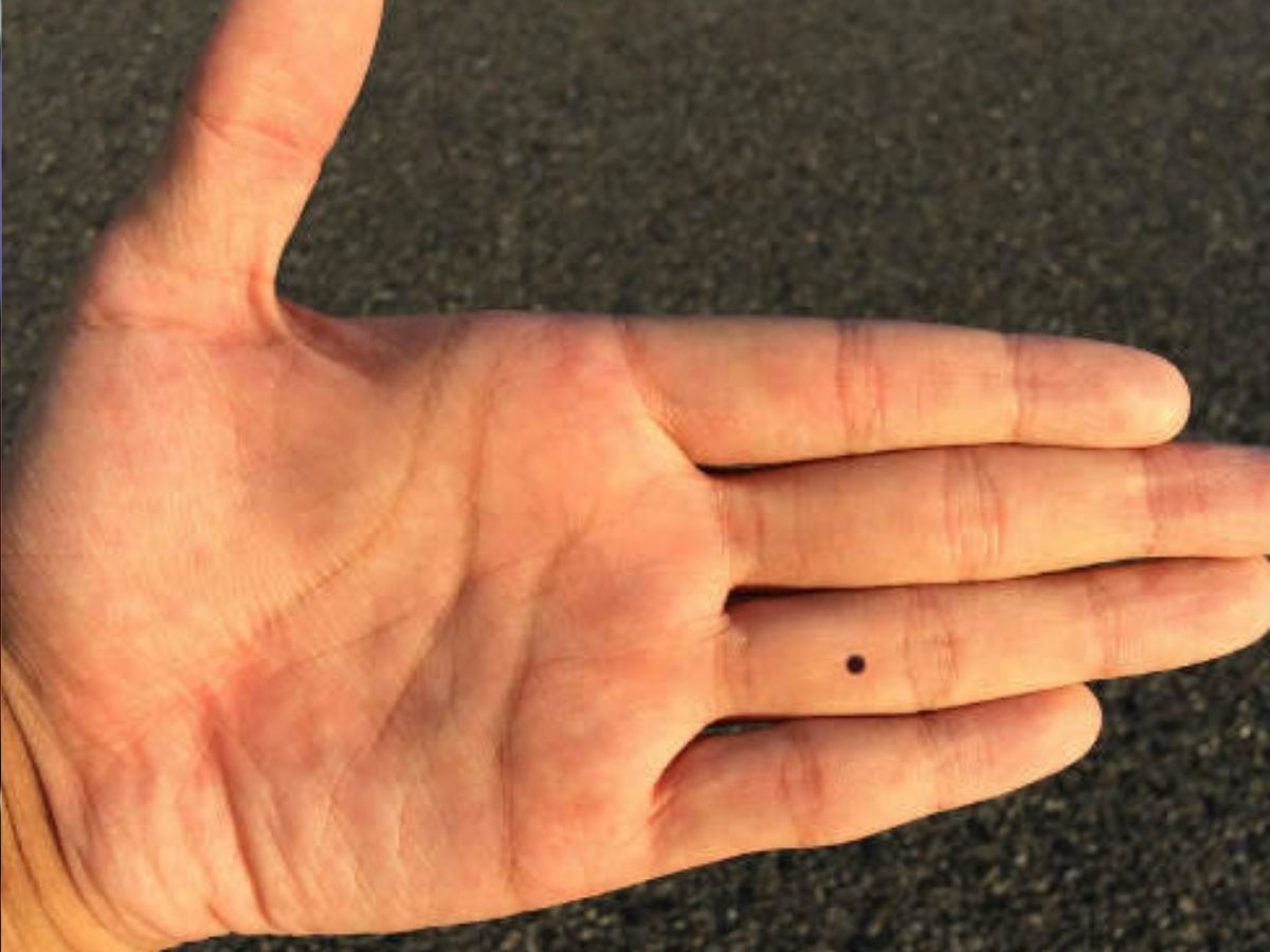 Meaning of Mole on Hand Janiye hatho me til hona kya matlab hota hain