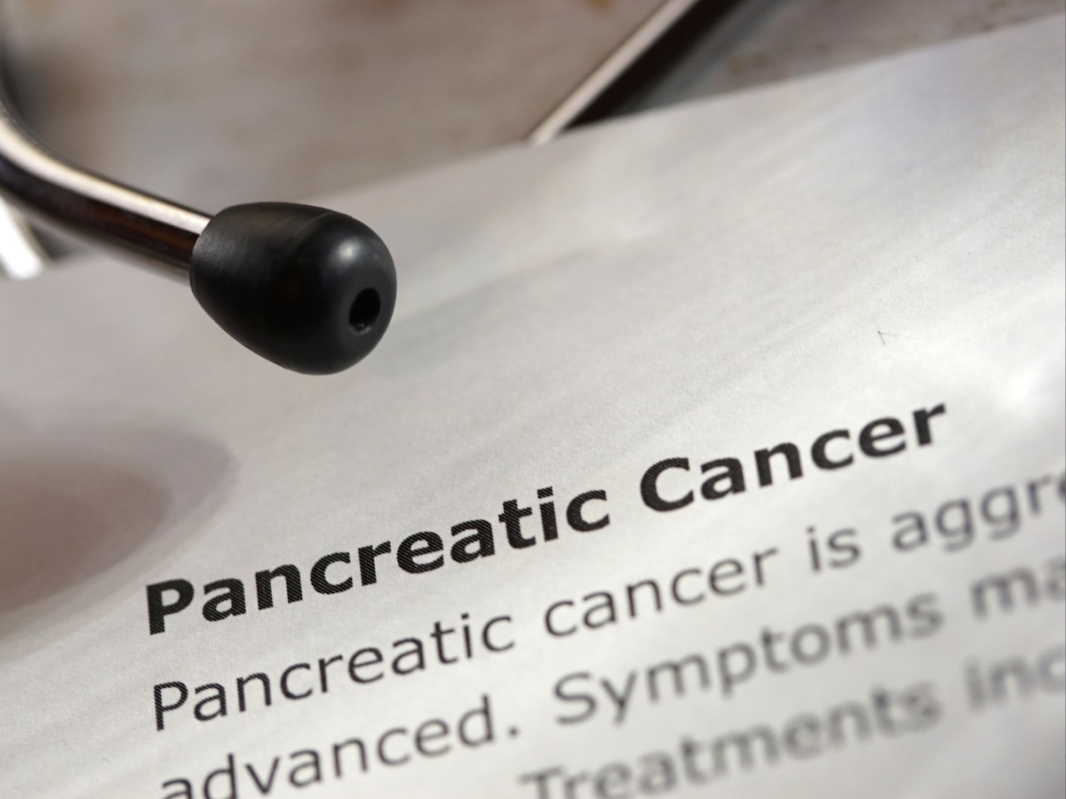 Three main lifestyle habits can cause pancreatic cancer in women