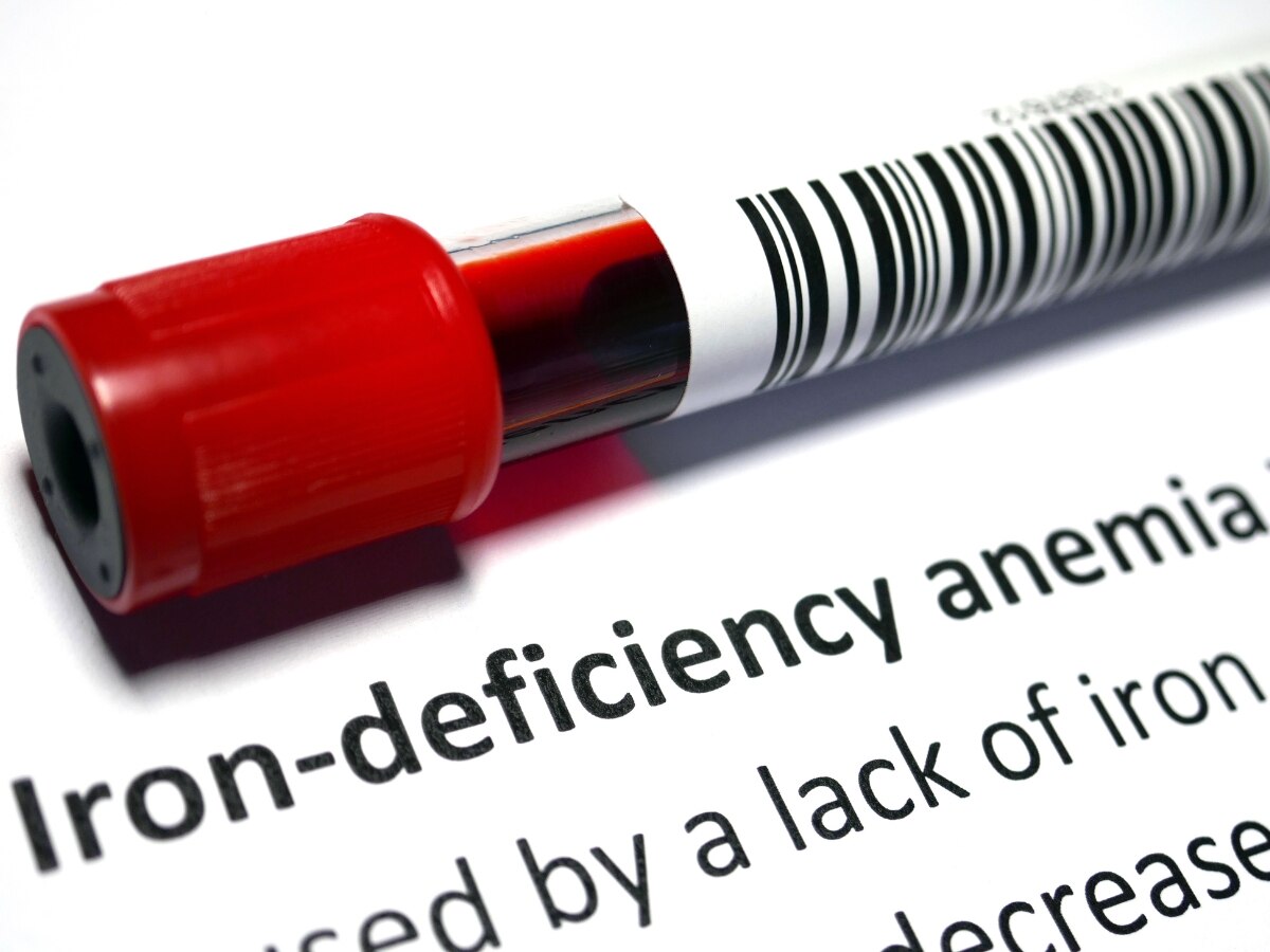 Iron Deficiency: थकान से लेकर त्वचा का पीला पड़ना, आयरन की कमी के 5 चेतावनी संकेतों को भूलकर न करें नजरअंदाज