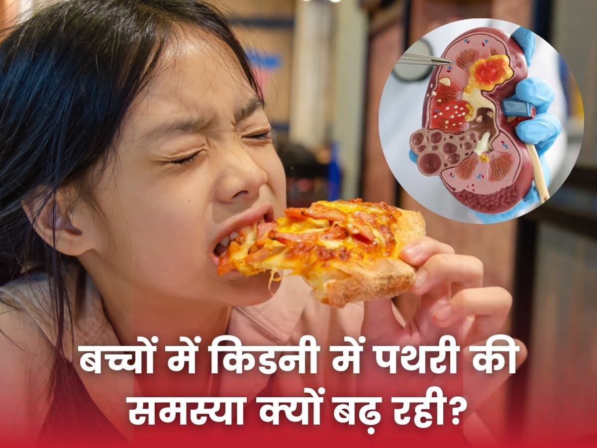 Kidney Stone In Children: बच्चों को तुरंत खिलाना छोड़े ये चीजें, वरना किडनी में पड़ जाएगी पथरी!