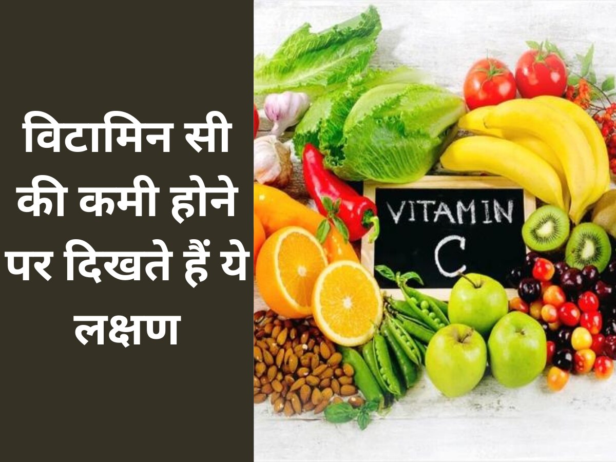 Vitamin-C: इन लक्षणों को न करें नजरअंदाज, हो सकती है इस विटामिन की कमी