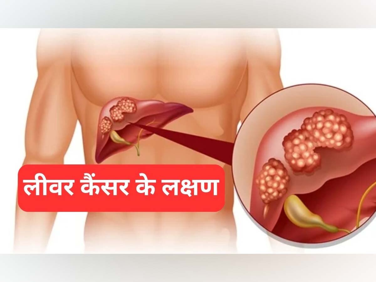 Liver Cancer Symptoms: इन 2 लक्षणों को गैस-एसिडिटी समझने की कभी न करें गलती, लीवर कैंसर के हो सकते हैं संकेत; ऐसे कर लें जांच