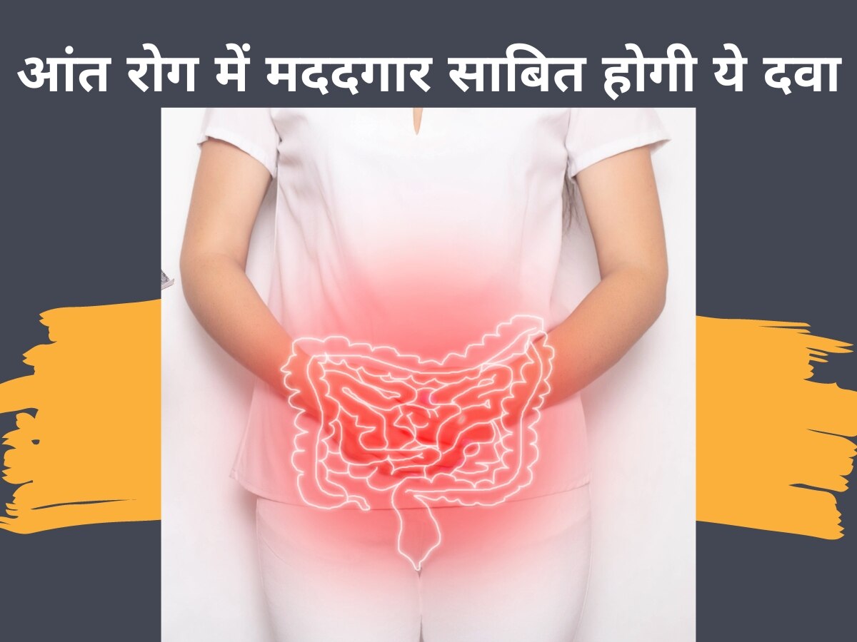 Bowel Disease: आंत की सूजन को कम करने में मददगार साबित हो सकती है त्वचा की दवा, शोध में मिले चौंकाने वाले परिणाम