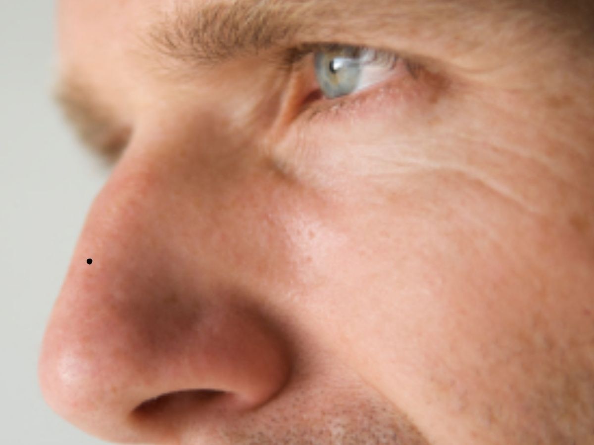 Mole Around Nose meaning in hindi naak ke aaspas til hona ka matlab