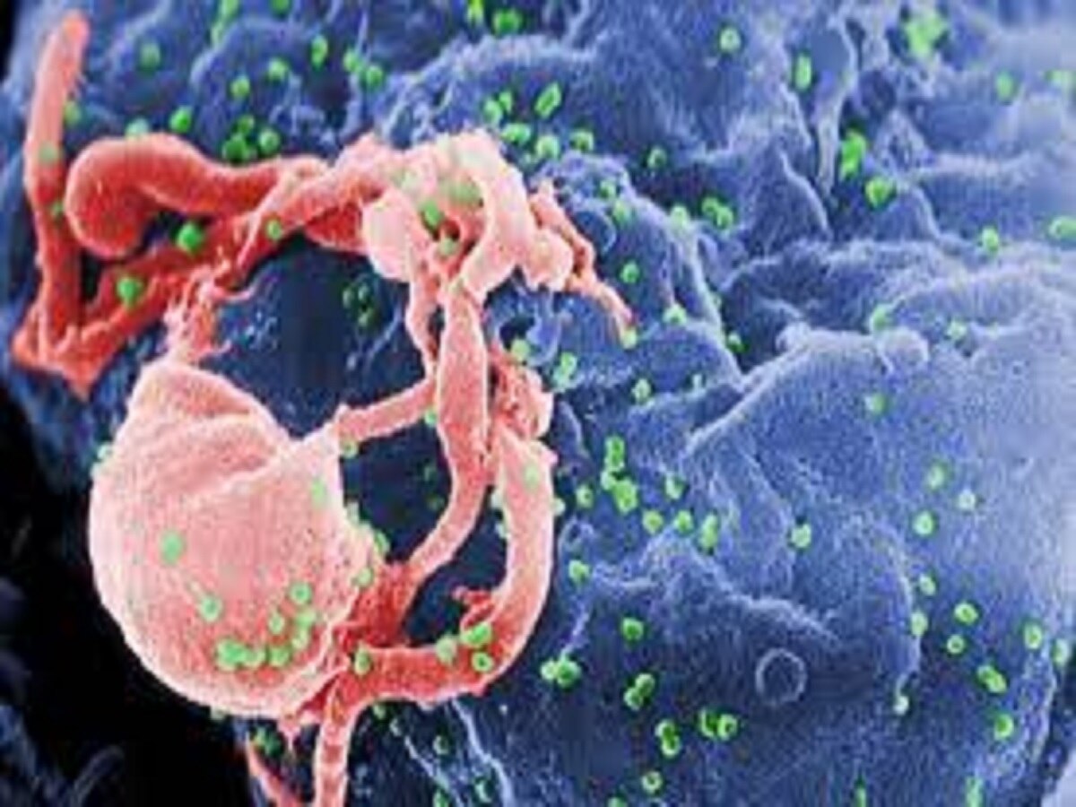 दिमाग के इस हिस्से में निष्क्रिय पड़ा रहता है HIV, इलाज नहीं होने पर पनपता है एड्स का संक्रमण