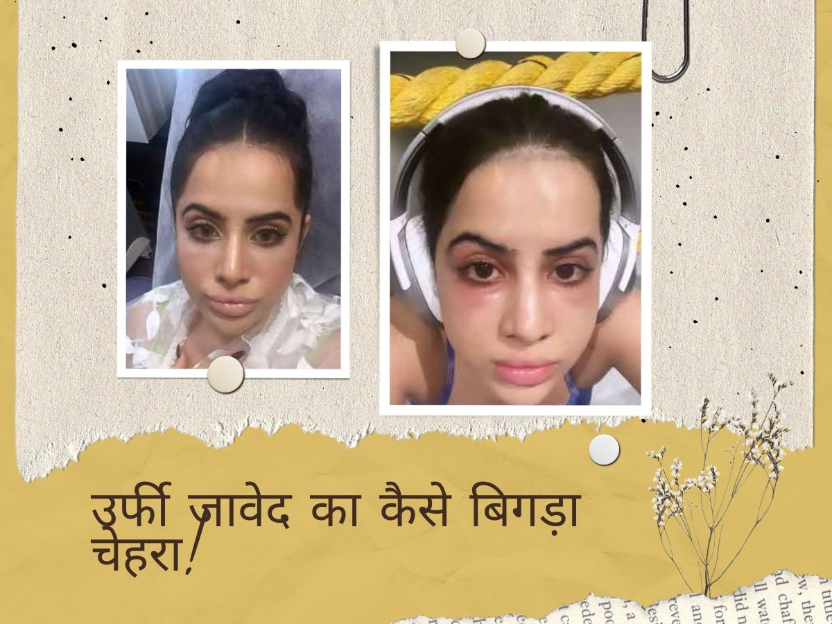 Urfi Javed की सूजी आंखें और होंठ, मेकअप से भी नहीं सुधर रही बिगड़ी सूरत!