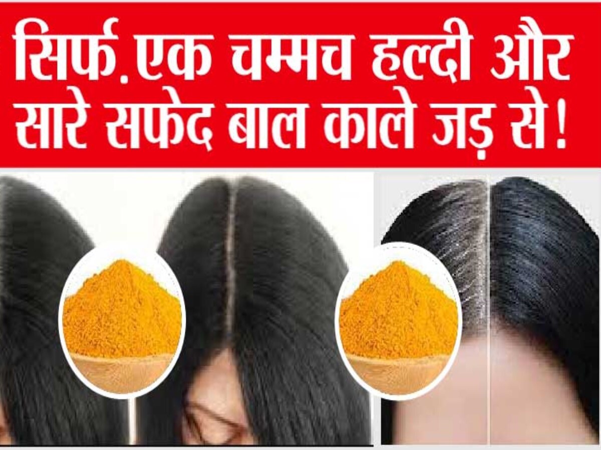 White Hair: सफेद बालों को जड़ से काला कर देती है हल्दी, ऐसे इस्तेमाल से दूर होंगी बालों की कई समस्याएं