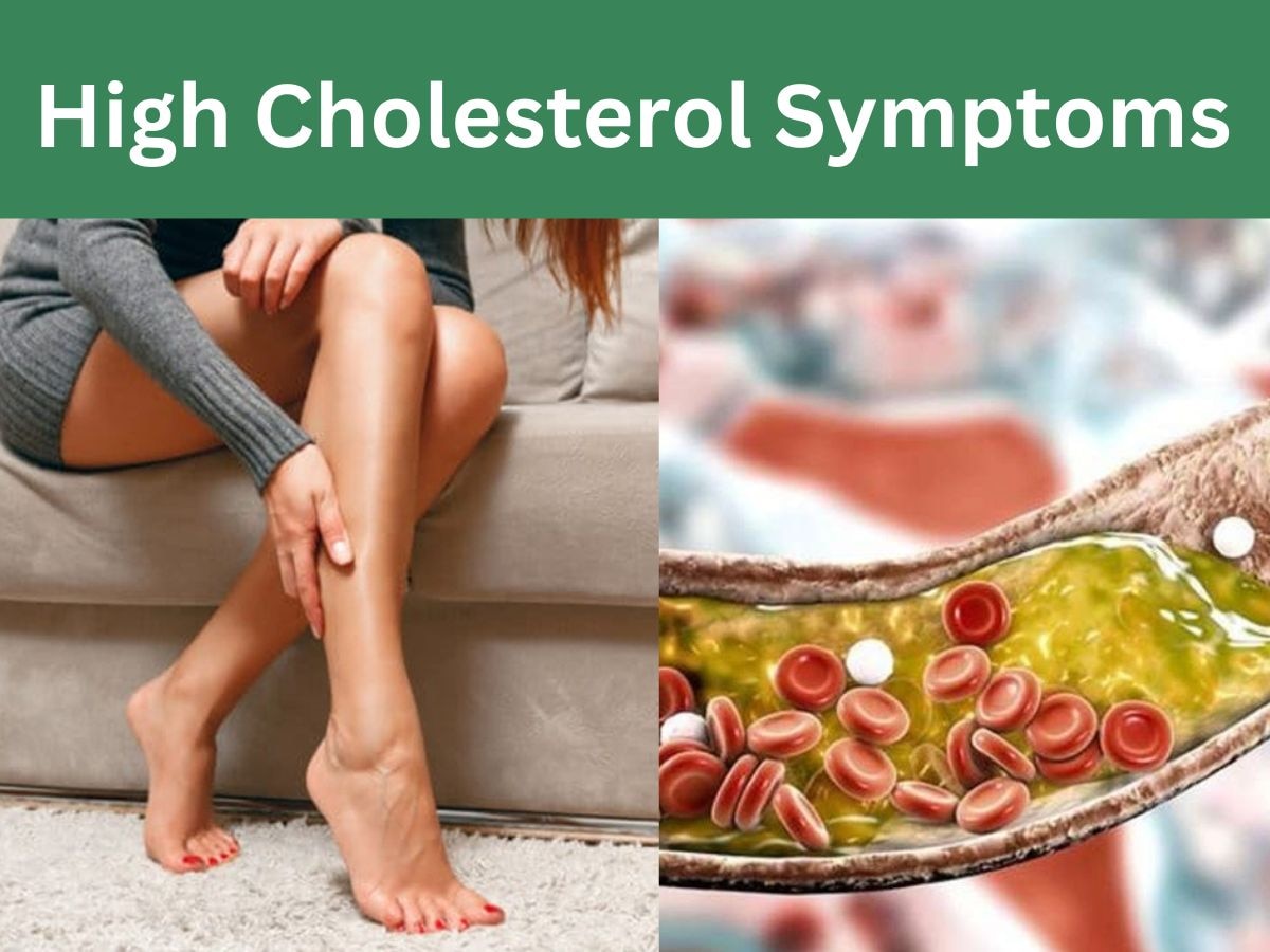 High Cholesterol Warning Sign: जब पैरों में होने लगे ऐसी परेशानी, न करें इग्नोर; कहीं ये हाई कोलेस्ट्रॉल का इशारा तो नहीं?