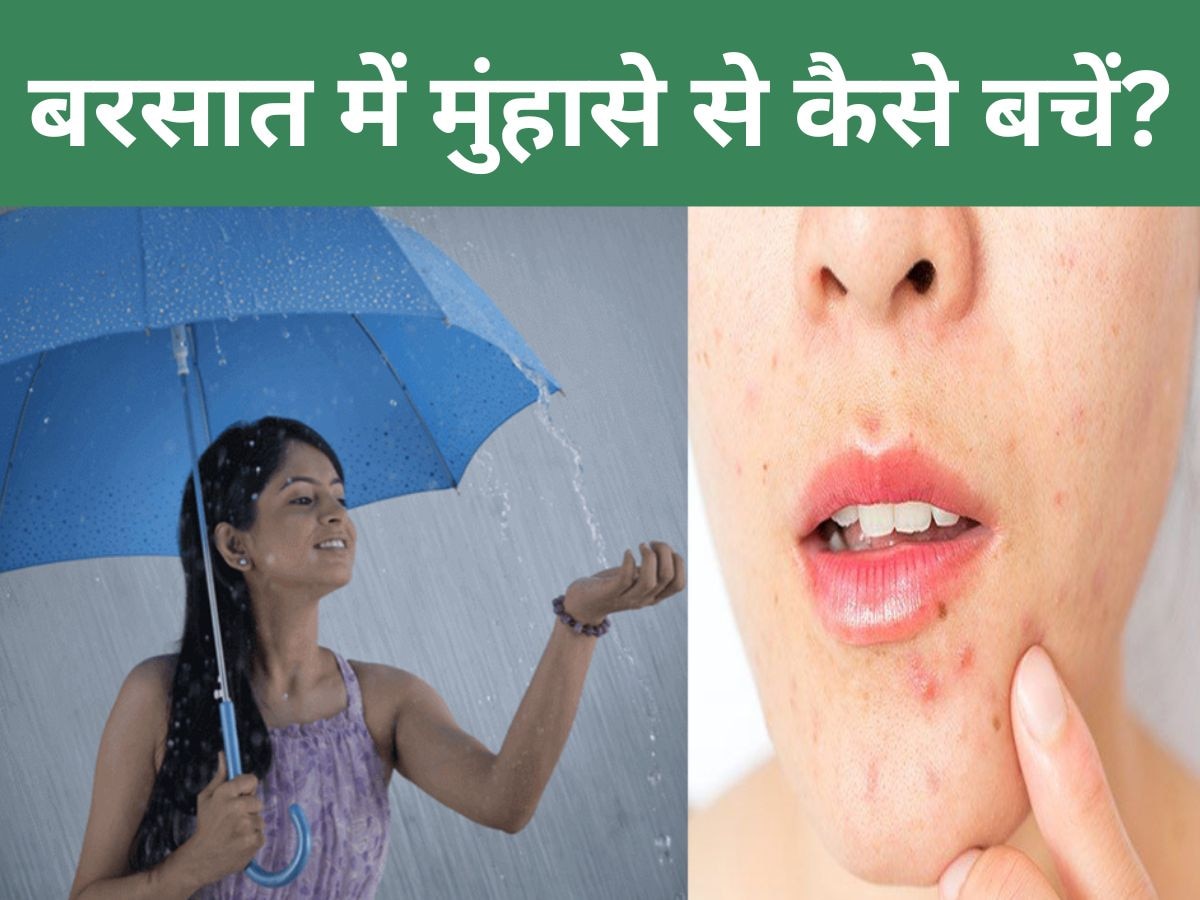 Monsoon Skin Care: बरसात के मौसम में चेहरे की त्वचा को ऐसे रखें हाइड्रेट, वरना आ जाएंगे मुंहासे