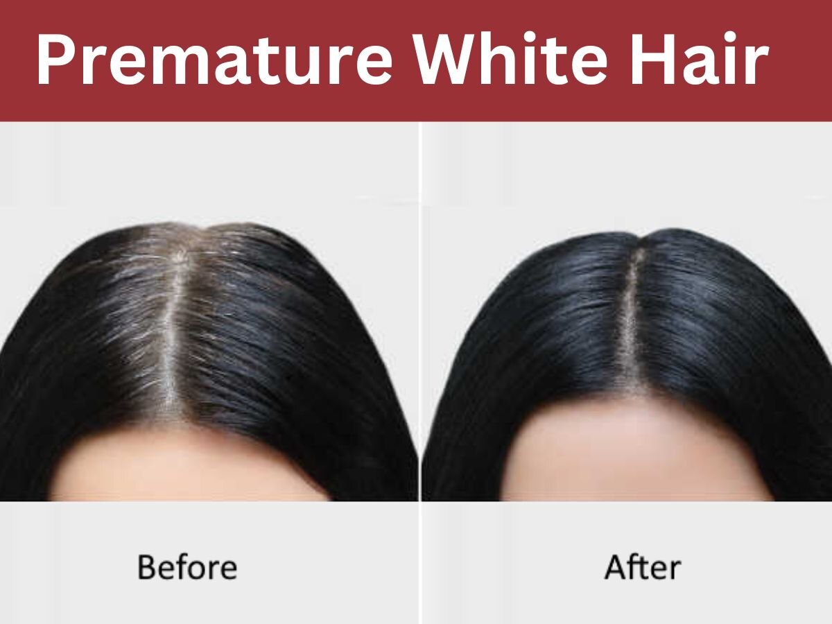 Premature White Hair: आईने में सफेद बालों को देखकर होती है टेंशन? इस सब्जी के छिलके से आएगी डार्कनेस