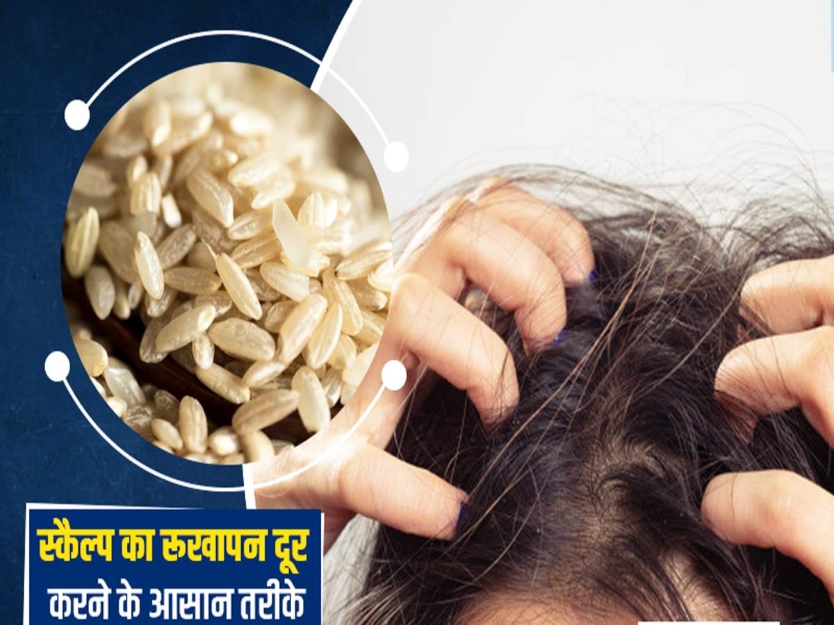 Dry Scalp Treatment: ड्राय स्कैल्प के कारण बालों में हो रही है लगातार खुलजी, तो घर पर ऐसे बनाएं स्पा क्रीम