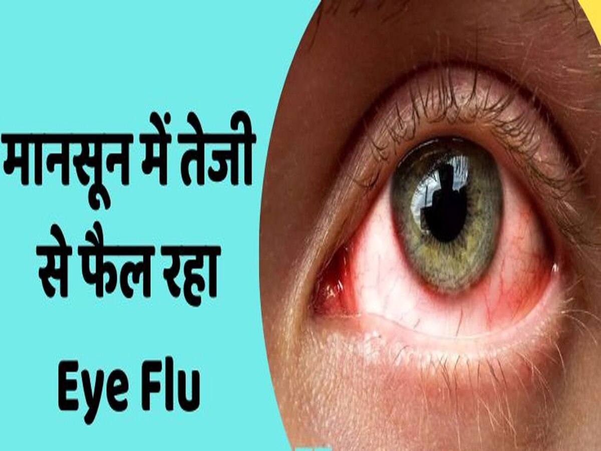 EYE Flu: दिल्ली में फैली आंखों की 'बेहद संक्रामक' बीमारी, एक्सपर्ट्स ने जारी किया हाई अलर्ट, जानें बचाव और उपाय