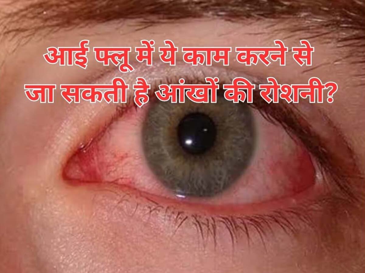 Eye Flu Remedies: आई फ्लू में ये काम करने से हमेशा के लिए हो सकते हैं अंधे, बिना देरी किए डॉक्टर से कर लें संपर्क