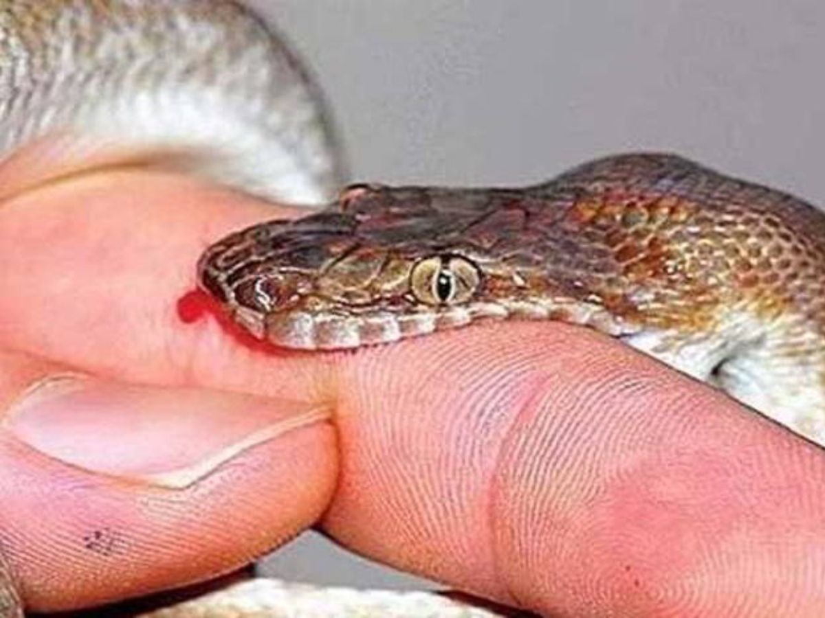 snake bite(File Photo)