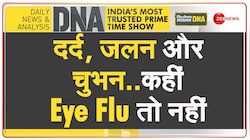 DNA: Eye Flu के संक्रमण से बचाने वाली मेडिकल रिपोर्ट 