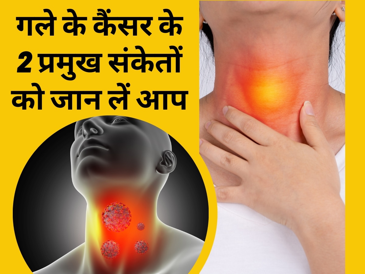 Throat cancer increases rapidly in young people of 18 to 30 years do